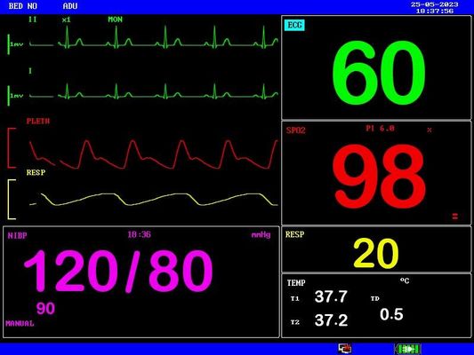 Rechargeable Battery Portable Patient Monitor Compact and Lightweight