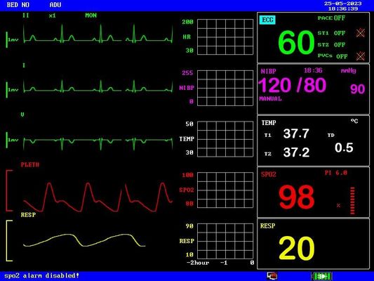 Rechargeable Battery Portable Patient Monitor Compact and Lightweight
